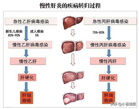 大三陽最新治療方法，探索與希望
